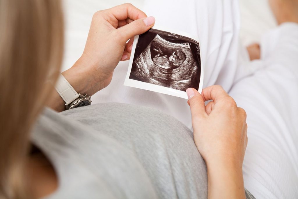 Woman holding a pregnancy scan image, acupuncture supports natural conception 